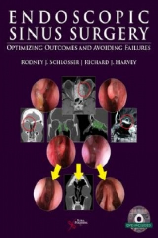 Книга Endoscopic Sinus Surgery Rodney J. Schlosser