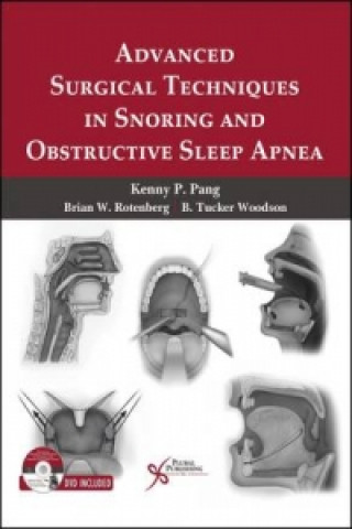 Libro Advanced Surgical Techniques in Snoring and Obstructive Sleep Apnea Kenny Peter Pang