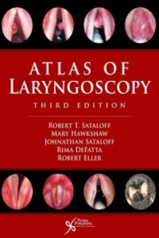 Carte Atlas of Laryngoscopy Robert Thayer Sataloff