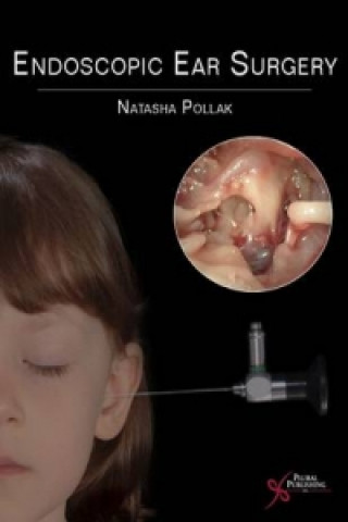 Kniha Endoscopic Ear Surgery Natasha Pollak