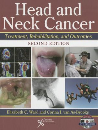 Kniha Head and Neck Cancer Elizabeth C. Ward