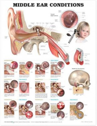 Könyv Middle Ear Conditions Anatomical Chart 
