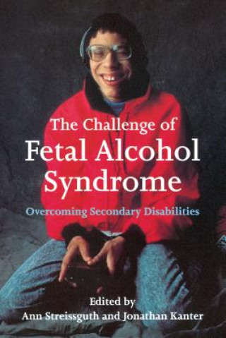 Kniha Challenge of Fetal Alcohol Syndrome Mike Lowry