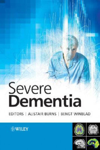 Książka Severe Dementia Burns