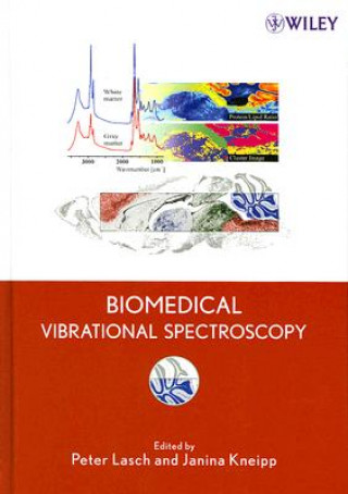 Książka Biomedical Vibrational Spectroscopy Peter Lasch