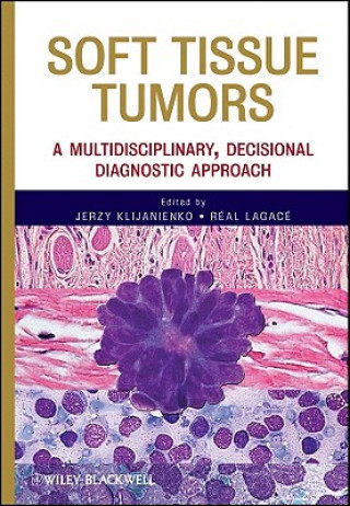 Carte Soft Tissue Tumors - A Multidisciplinary, Decisional Diagnostic Approach Jerzy Klijanienko