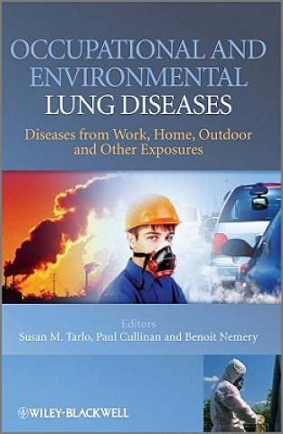 Buch Occupational and Environmental Lung Diseases - Diseases from Work, Home, Outdoor and Other Exposures Susan Tarlo