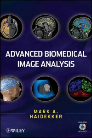 Buch Advanced Biomedical Image Analysis Mark A. Haidekker