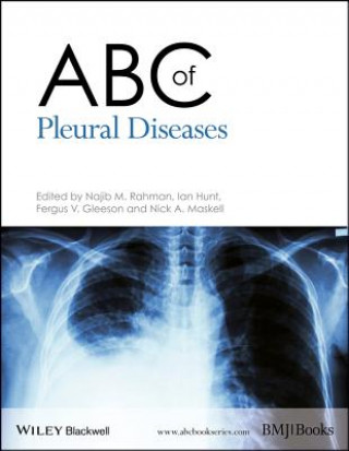 Könyv ABC of Pleural Diseases Ian Hunt