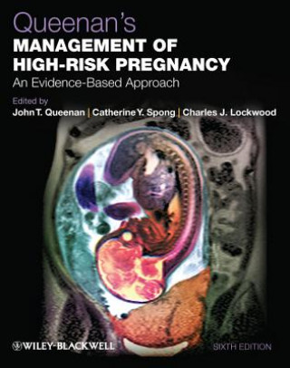 Book Queenan's Management of High-Risk Pregnancy - An Evidence-Based Approach 6e John T. Queenan