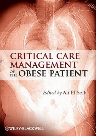 Könyv Critical Care Management of the Obese Patient Ali El Solh