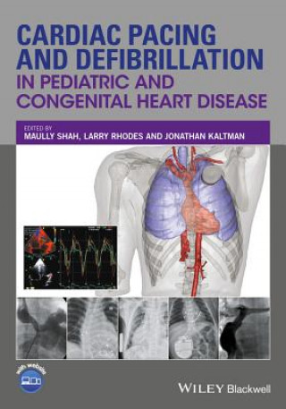 Buch Cardiac Pacing and Defibrillation in Pediatric and  Congenital Heart Disease Maully Shah