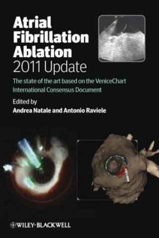 Könyv Atrial Fibrillation Ablation 2011 Update - The State of the Art based on the VeniceChart International Consensus Document Andrea Natale