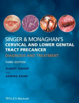 Kniha Singer & Monaghan's Cervical and Lower Genital Tract Precancer - Diagnosis and Treatment 3e Quek Swee Chong