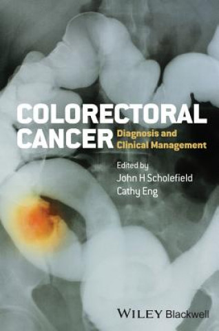 Könyv Colorectal Cancer - Diagnosis and Clinical Management John H. Scholefield