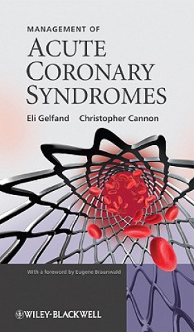 Carte Management of Acute Coronary Syndromes Eli Gelfand