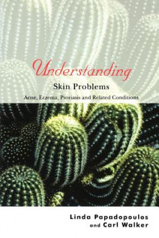 Book Understanding Skin Problems - Acne, Eczema, Psoriasis and Related Conditions Linda Papadopoulos