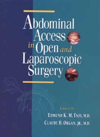 Könyv Abdominal Access in Open and Laparoscopic Surgery Edmund K. M. Tsoi