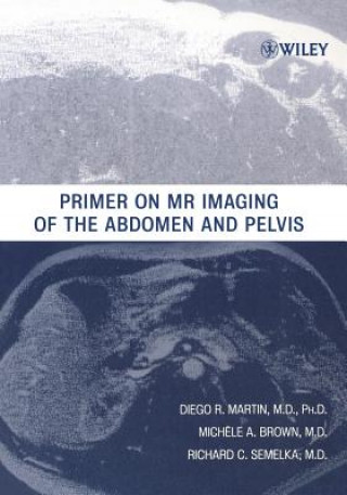 Könyv Primer on MR Imaging of the Abdomen and Pelvis Richard C. Semelka