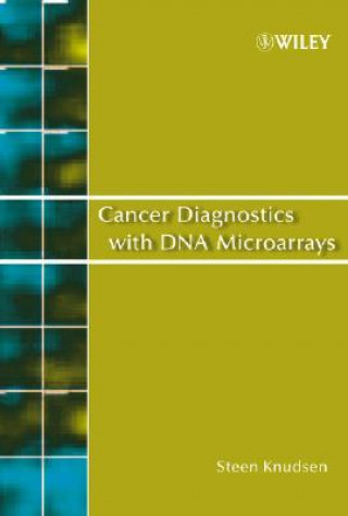 Carte Cancer Diagnostics with DNA Microarrays Steen Knudsen