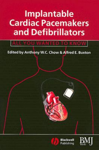 Kniha Implantable Cardiac Pacemakers and Defibrillators Anthony W. C. Chow