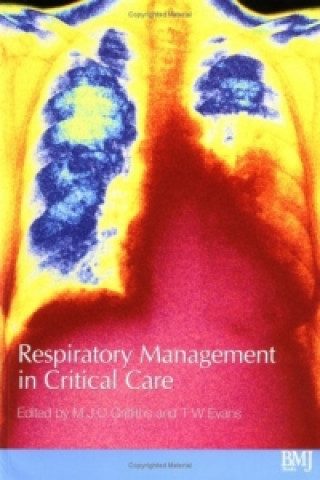 Könyv Respiratory Management in Critical Care Mark J. D. Griffiths