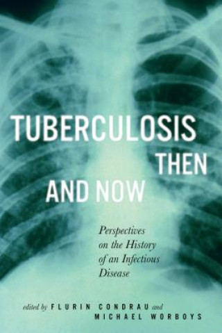 Kniha Tuberculosis Then and Now Flurin Condrau