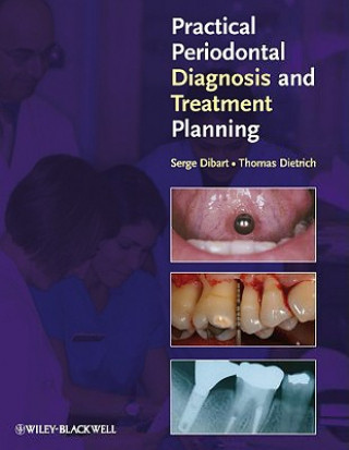 Kniha Practical Periodontal Diagnosis and Treatment Planning Serge Dibart