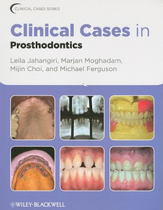 Könyv Clinical Cases in Prosthodontics Leila Jahangiri
