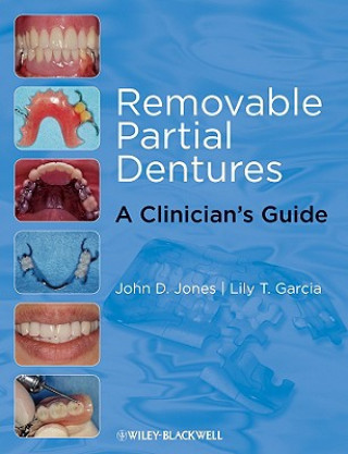 Kniha Removable Partial Dentures John D. Jones