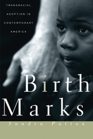 Buch Birthmarks Sandra Patton