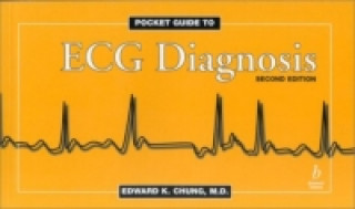Kniha Pocket Guide to ECG Diagnosis Edward K. Chung