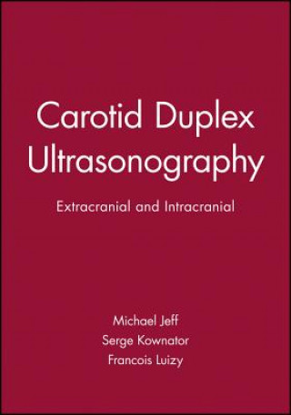 Digital Carotid Duplex Ultrasonography Michael R. Jaff