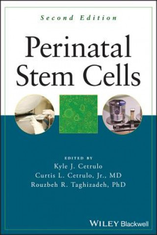 Boek Perinatal Stem Cells, Second Edition Kyle Cetrulo