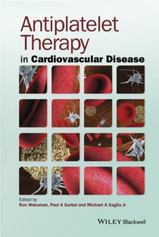 Kniha Antiplatelet Therapy in Cardiovascular Disease Ron Waksman