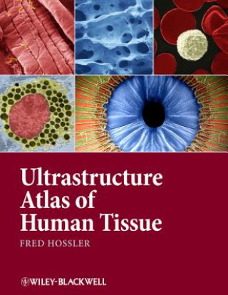 Kniha Ultrastructure Atlas of Human Tissues Fred Hossler