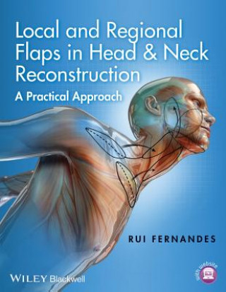 Kniha Local and Regional Flaps in Head & Neck Reconstruction - A Practical Approach Rui Fernandes