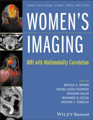 Kniha Women's Imaging - MRI with Multimodality Correlation Michele A. Brown