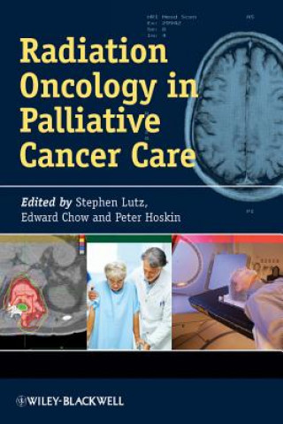 Könyv Radiation Oncology in Palliative Cancer Care Stephen Lutz