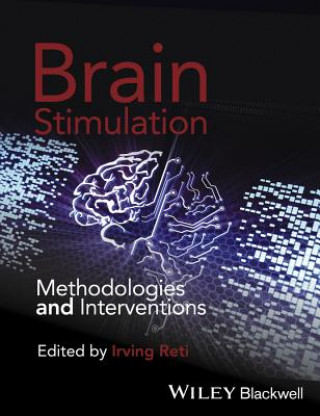 Könyv Brain Stimulation - Methodologies and Interventions Irving Reti