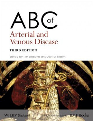 Kniha ABC of Arterial and Venous Disease 3e Tim England