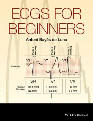 Buch ECGs for Beginners Antonio Bayes de Luna