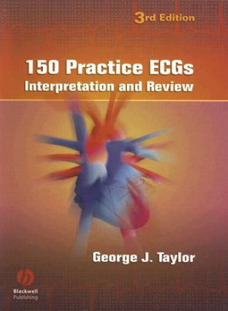 Carte 150 Practice ECGs - Interpretation and Review 3e George Taylor