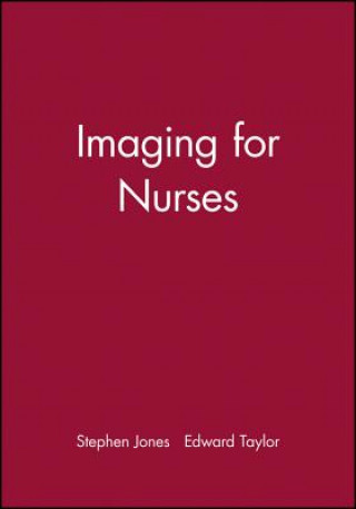 Книга Imaging for Nurses Stephen Jones