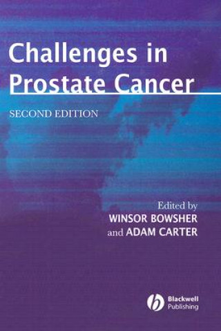 Carte Challenges in Prostate Cancer 2e Winsor Bowsher
