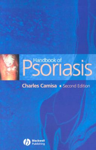 Książka Handbook of Psoriasis 2e Charles Camisa