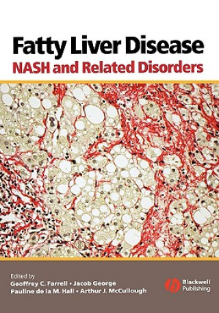 Knjiga Fatty Liver Disease - NASH and Related Disorders Farrell