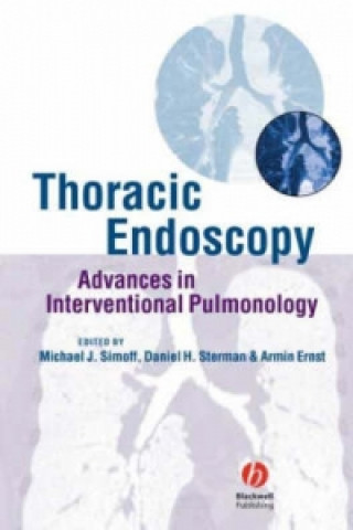Carte Thoracic Endoscopy - Advances in Interventional Pulmonology Michael J. Simoff