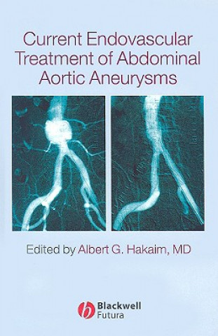 Książka Current Endovascular Treatment of Abdominal Aortic Aneurysms Albert Hakaim