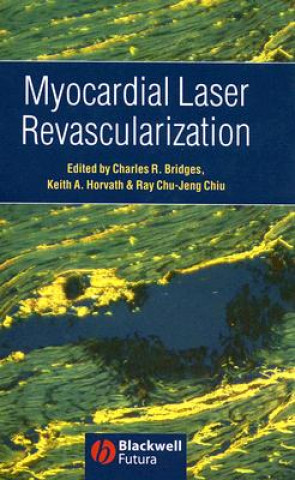 Książka Myocardial Laser Revascularization Charles Bridges